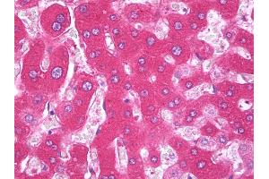 Anti-F9 / Factor IX antibody IHC of human liver.