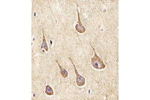(ABIN6242948 and ABIN6577962) staining NPY2R in Human brain tissue sections by Immunohistochemistry (IHC-P - paraformaldehyde-fixed, paraffin-embedded sections).