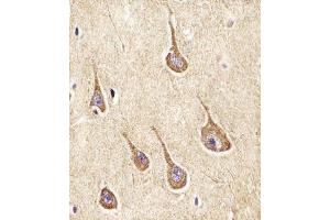 (ABIN6242948 and ABIN6577962) staining NPY2R in Human brain tissue sections by Immunohistochemistry (IHC-P - paraformaldehyde-fixed, paraffin-embedded sections). (NPY2R anticorps  (N-Term))