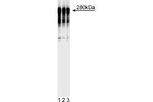Western Blotting (WB) image for anti-Microtubule-Associated Protein 2 (MAP2) antibody (ABIN967494)