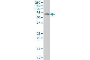 UBQLN2 polyclonal antibody (A01), Lot # 061101JCS1 Western Blot analysis of UBQLN2 expression in Jurkat .