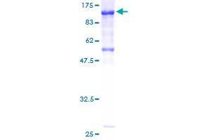 Image no. 1 for Cadherin 7 (CDH7) (AA 1-630) protein (GST tag) (ABIN1348924) (Cadherin 7 Protein (CDH7) (AA 1-630) (GST tag))