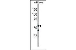 Western blot analysis of ATG4D Antibody  in mouse kidney tissue lysate. (ATG4D anticorps  (AA 227-257))
