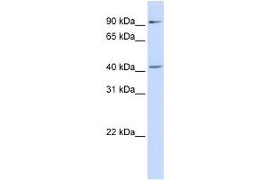 WB Suggested Anti-SOX17 Antibody Titration:  0. (SOX17 anticorps  (Middle Region))