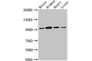 Western Blot Positive WB detected in: Rat brain tissue, Rat kidney tissue, Mouse heart tissue, Mouse liver tissue All lanes: NAA15 antibody at 3 μg/mL Secondary Goat polyclonal to rabbit IgG at 1/50000 dilution Predicted band size: 102, 62 kDa Observed band size: 95 kDa (NAA15 anticorps  (AA 742-865))