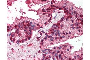 Anti-TNFRSF19 / TROY antibody IHC of human prostate. (TNFRSF19 anticorps  (AA 29-44))