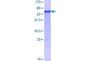 Image no. 1 for Hydroxymethylbilane Synthase (HMBS) (AA 1-361) protein (GST tag) (ABIN1306784)