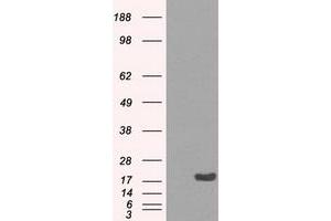 Image no. 2 for anti-Crystallin, alpha B (CRYAB) antibody (ABIN1497641) (CRYAB anticorps)