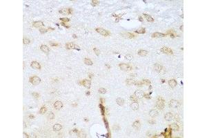 Immunohistochemistry of paraffin-embedded Mouse brain using UBE2L3 Polyclonal Antibody at dilution of 1:100 (40x lens). (UBE2L3 anticorps)