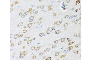 Immunohistochemistry of paraffin-embedded Rat brain using OGN Polyclonal Antibody at dilution of 1:100 (40x lens). (OGN anticorps)