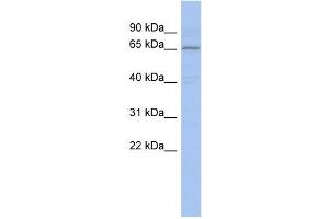 WB Suggested Anti-PIAS1 Antibody Titration:  0.