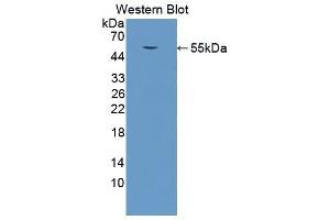 Western Blotting (WB) image for anti-Cathepsin K (CTSK) (AA 113-316) antibody (ABIN1858551)