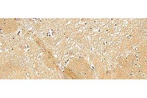 Immunohistochemistry of paraffin-embedded Human brain tissue using TXNDC12 Polyclonal Antibody at dilution of 1:50(x200)