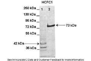 Lanes:   Lane1: HIS-HCFC1 16-363aa (42kD) transformed bacteria lysate Lane2: GFP-HCFC1 363-2002aa (73kD) transformed bacteria lysate elution sample  Primary Antibody Dilution:   1:1000  Secondary Antibody:   Anti-rabbit AlexaFluor 680  Secondary Antibody Dilution:   1:10000  Gene Name:   HCFC1  Submitted by:   Anonymous (HCFC1 anticorps  (Middle Region))