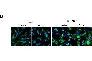Silencing PLAUR affects proteins involved in DNA metabolism, synthesis and repair(A) Gene interacting networks generated using IPA showing the interacting genes and biological processes involving metabolism and incorporation of nucleotides, (B) MDA-MB-231 cells silenced for PLAUR were irradiated at 9 Gy, after 6 h cells were fixed and stained for 8-OHdG antibody. (8-OHDG anticorps)