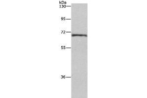 Western Blot analysis of Human normal liver tissue using HSF27 Polyclonal Antibody at dilution of 1:655 (CDK5RAP3 anticorps)