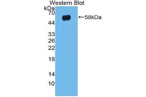Western Blotting (WB) image for anti-Taxilin alpha (TXLNA) (AA 1-234) antibody (ABIN1980518) (alpha Taxilin anticorps  (AA 1-234))