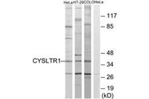 Western blot analysis of extracts from COLO205/HT-29/HeLa cells, using CYSLTR1 Antibody.