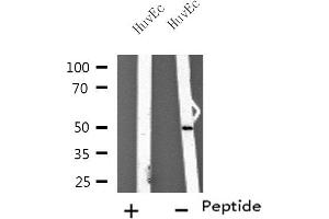 Western blot analysis of extracts from HuvEc cells using TUBA3C/E antibody. (TUBA3C/E anticorps)