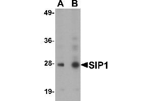 Western Blotting (WB) image for anti-Gem (Nuclear Organelle) Associated Protein 2 (GEMIN2) (C-Term) antibody (ABIN1030662) (SIP1 anticorps  (C-Term))
