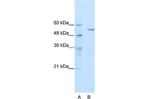 WB Suggested Anti-TRIM35 Antibody Titration:  0. (TRIM35 anticorps  (C-Term))