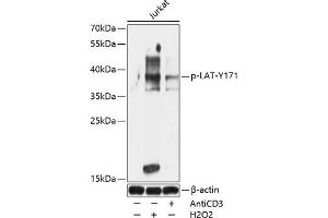 Western blot analysis of extracts of Jurkat cells, using Phospho-LAT-Y171 antibody (ABIN7268273) at 1:1000 dilution. (LAT anticorps  (pTyr171))