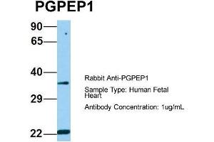 Host: Rabbit  Target Name: PGPEP1  Sample Tissue: Human Fetal Heart  Antibody Dilution: 1. (PGPEP1 anticorps  (N-Term))
