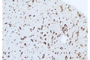 ABIN6276418 at 1/100 staining Mouse brain tissue by IHC-P. (Caspase 1 anticorps  (C-Term))