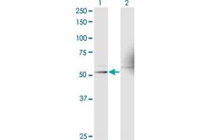 Western Blot analysis of RXRA expression in transfected 293T cell line by RXRA monoclonal antibody (M17), clone 1G1.