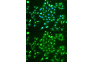 Immunofluorescence analysis of A549 cell using UCHL5 antibody. (UCHL5 anticorps)