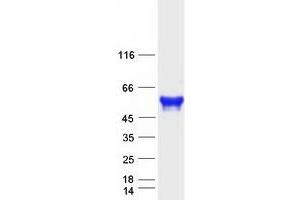 Validation with Western Blot