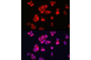 Immunofluorescence analysis of HepG2 cells using TFR2 Rabbit pAb (ABIN6128863, ABIN6149063, ABIN6149064 and ABIN6225172) at dilution of 1:100 (40x lens). (Transferrin Receptor 2 anticorps  (AA 582-801))