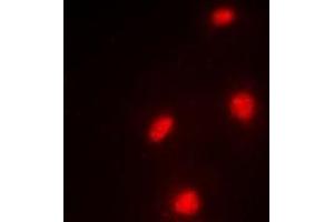 Immunofluorescent analysis of MTF-2 staining in A549 cells. (MTF2 anticorps)