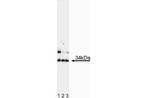 Western blot analysis of MASH1. (ASCL1 anticorps)