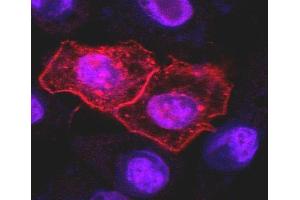 Immunocytochemistry staining (confocal microscopy) of HeLa human cervix carcinoma cell line transfected with TRAIL-R1 expression plasmid using anti-human TRAIL-R1 (DR-4-02).