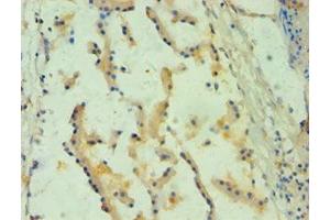 Immunohistochemistry of paraffin-embedded human prostate tissue using ABIN7157738 at dilution of 1:100 (SPINT1 anticorps  (AA 250-529))