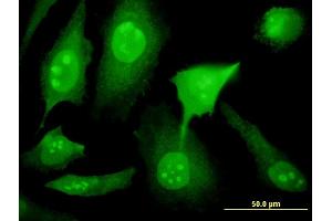 Immunofluorescence of monoclonal antibody to YY1AP1 on HeLa cell. (YY1AP1 anticorps  (AA 1-739))