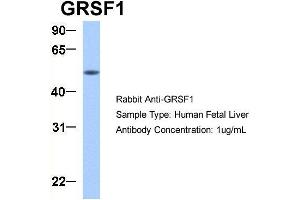 Host:  Rabbit  Target Name:  GRSF1  Sample Type:  Human Fetal Liver  Antibody Dilution:  1. (GRSF1 anticorps  (Middle Region))