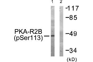 Western blot analysis of extracts from COS-7 cells, treated with A (125 ng/mL, 30 mins), using PKA-R2β (Phospho-Ser113) antibody.