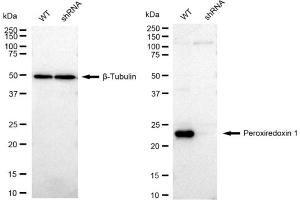 Western blotting analysis using Peroxiredoxin 1 antibody (ABIN7799776). (Recombinant Peroxiredoxin 1 anticorps)