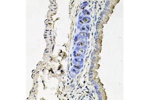 Immunohistochemistry of paraffin-embedded mouse lung using SLC39A4 antibody (ABIN5971796) at dilution of 1/100 (40x lens). (SLC39A4 anticorps)