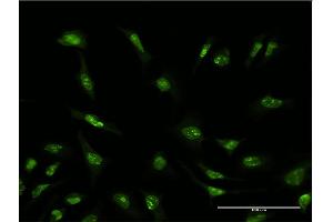 Immunofluorescence of monoclonal antibody to SFRS6 on HeLa cell.