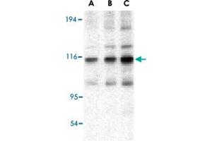 Western blot analysis of TRAF2 in mouse liver tissue lysate with TRAF2 polyclonal antibody  at (A) 0. (TRAF2 anticorps  (C-Term))