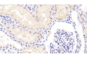 Detection of PSMD6 in Human Kidney Tissue using Polyclonal Antibody to Proteasome 26S Subunit, Non ATPase 6 (PSMD6)