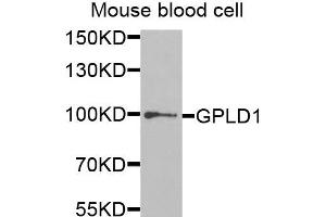 Western blot analysis of extracts of mouse blood cells, using GPLD1 antibody. (GPLD1 anticorps)