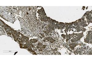IHC analysis of PARP using anti-PARP antibody (ABIN7602276). (PARP1 anticorps  (AA 670-858))