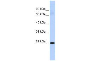 RBPMS2 antibody used at 1 ug/ml to detect target protein.