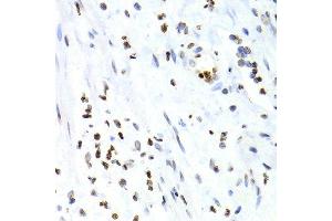 Immunohistochemistry of paraffin-embedded human vermiform appendix using NFKB2 Antibody.