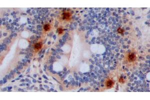 Detection of 5-HT in Porcine Small intestine Tissue using Polyclonal Antibody to 5-Hydroxytryptamine (5-HT) (Serotonin anticorps)