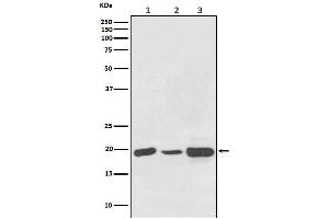 Western blot analysis of NDUFB8 expression in (1) HeLa cell lysate, (2) NIH/3T3 cell lysate, (3) PC12 cell lysate.